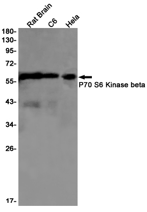 P70 S6 Kinase beta
