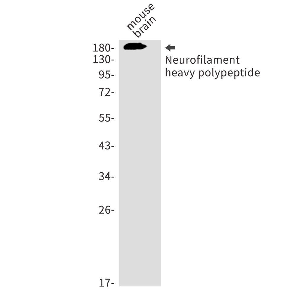 Neurofilament heavy polypeptide