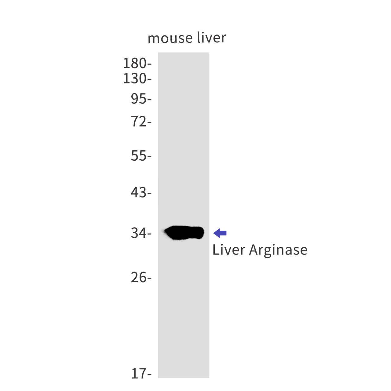 Liver Arginase