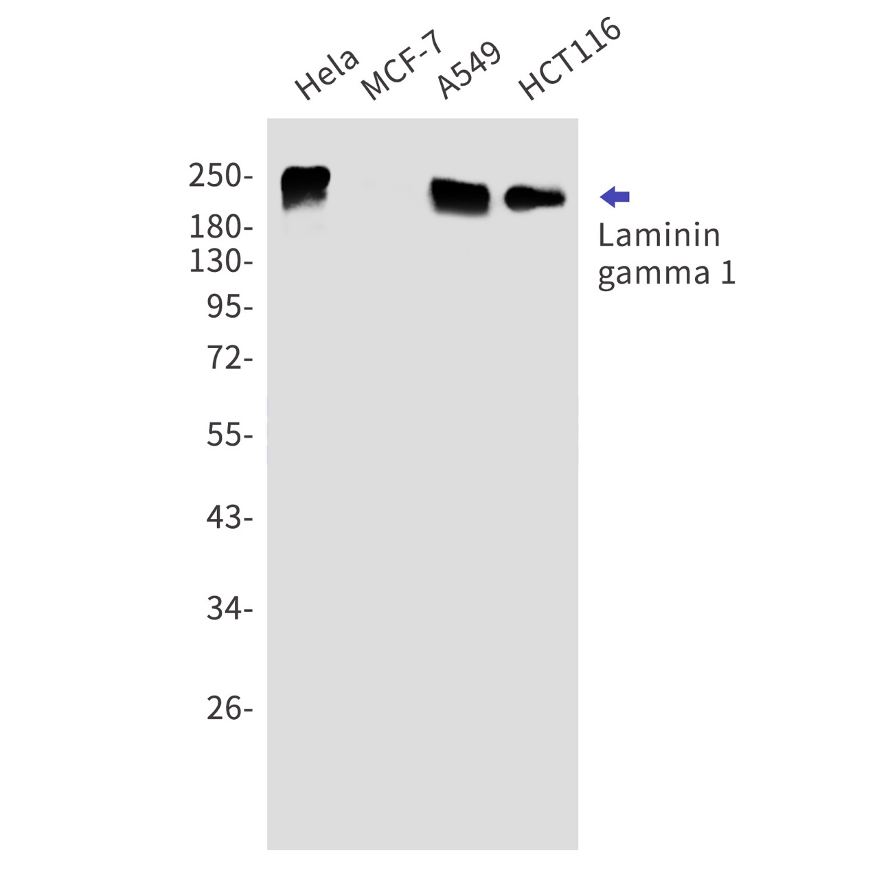 Laminin gamma 1