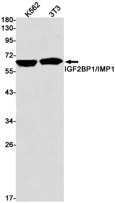 IGF2BP1