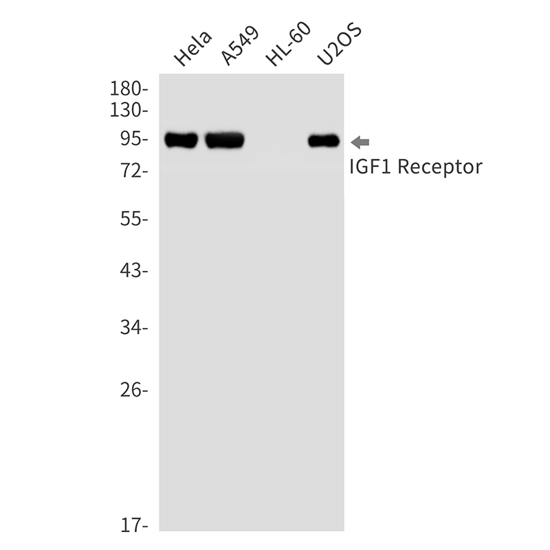 IGF1 Receptor