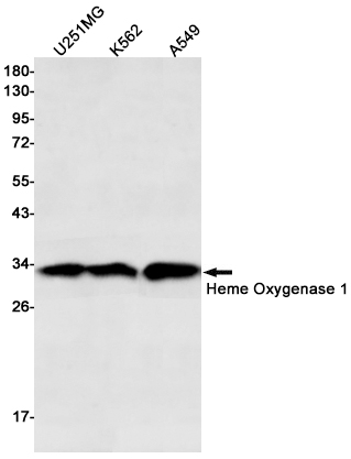 Heme Oxygenase 1