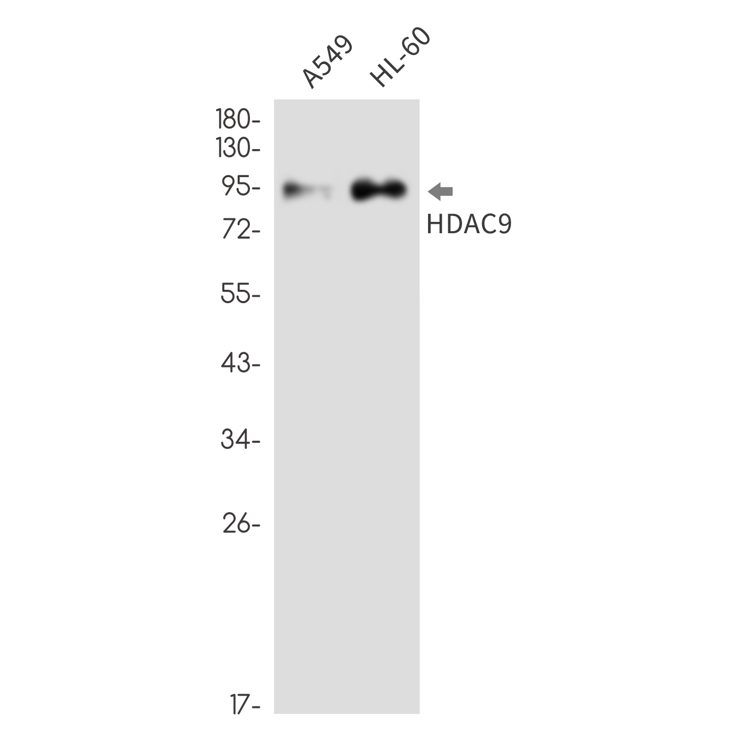 HDAC9