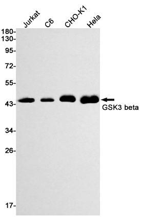 GSK3 beta