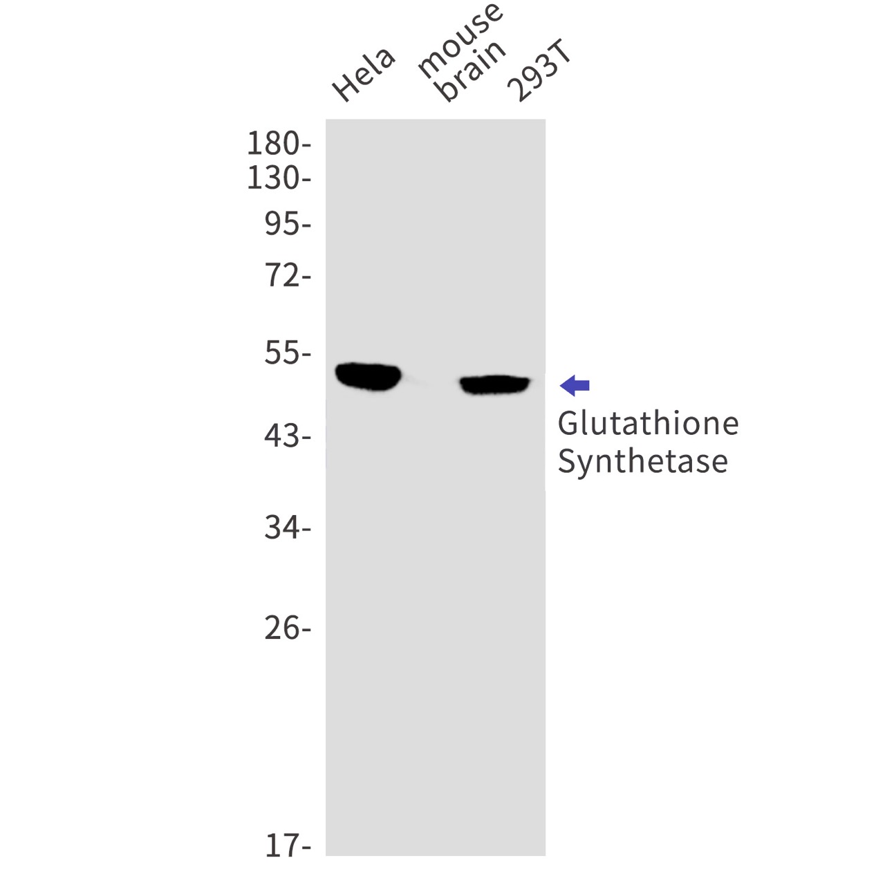 Glutathione Synthetase