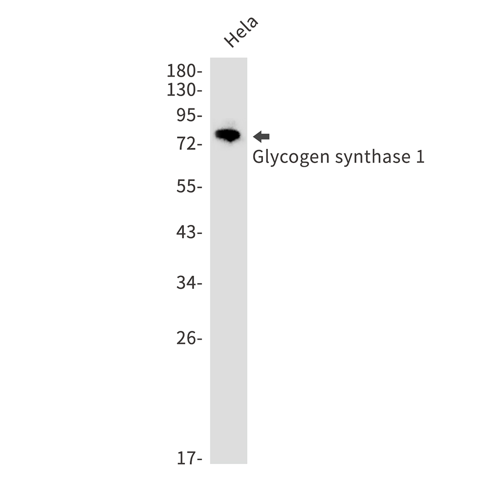 Glycogen synthase 1