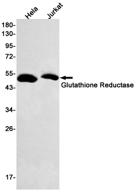 Glutathione Reductase