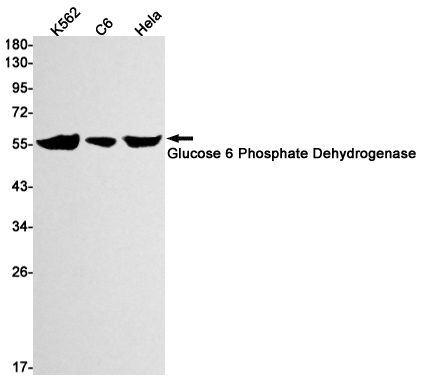 Glucose 6 Phosphate Dehydrogenase