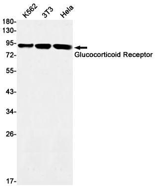 Glucocorticoid Receptor