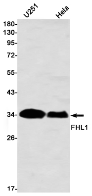 FHL1