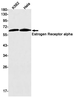 Estrogen Receptor alpha