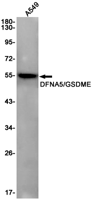 DFNA5/GSDME