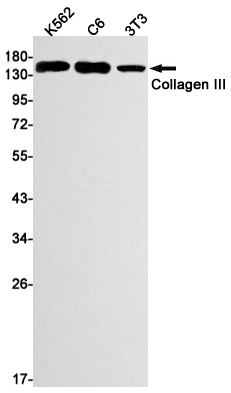 Collagen III