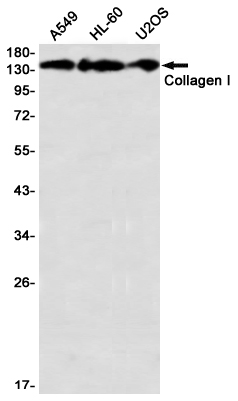 Collagen I alpha 1