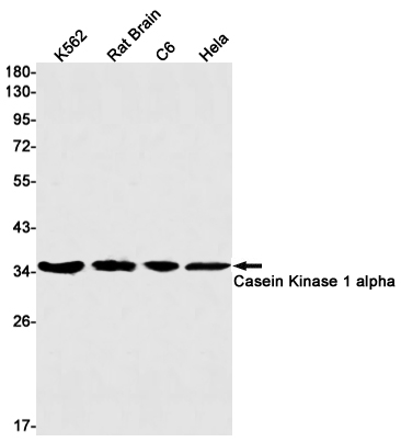 Casein Kinase 1 alpha