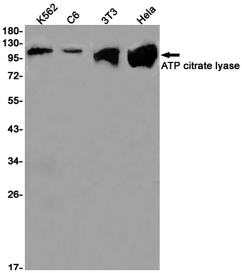 ATP Citrate lyase