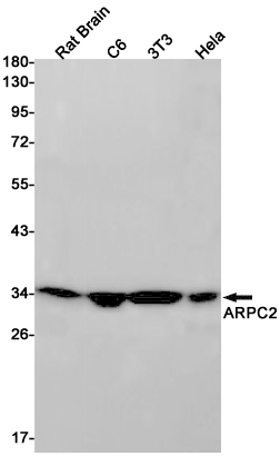 ARPC2