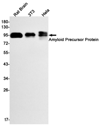 Amyloid Precursor Protein