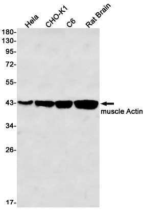 alpha Skeletal Muscle Actin