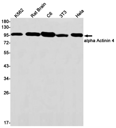 alpha Actinin 4