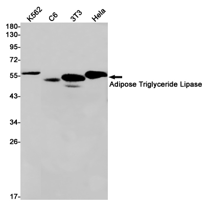 Adipose Triglyceride Lipase