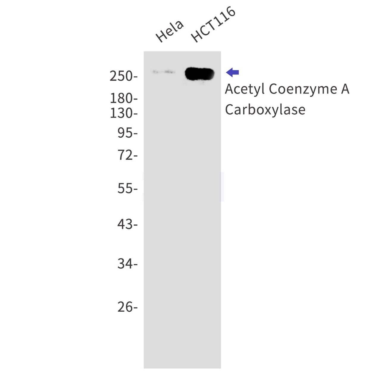 Acetyl Coenzyme A Carboxylase