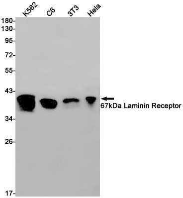 67kDa Laminin Receptor