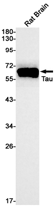 Phospho~Tau (Ser396)