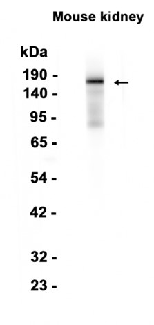 Angiotensin Converting Enzyme 1