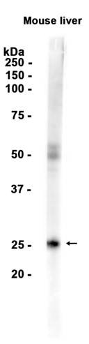 Mannan Binding Lectin