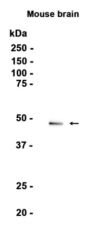 Dopamine Receptor D3/DRD3