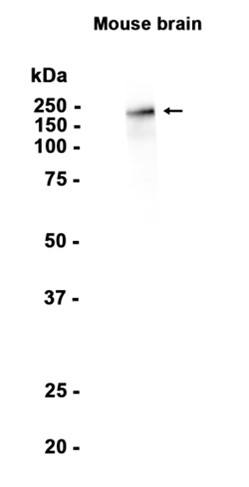 Neurofilament heavy polypeptide