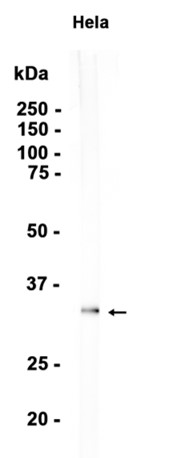 Annexin V/ANXA5