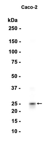 Prostaglandin dehydrogenase 1