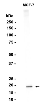 Ferritin light chain