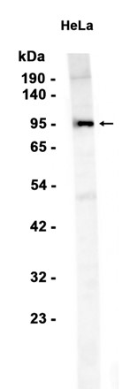 Insulin Receptor beta