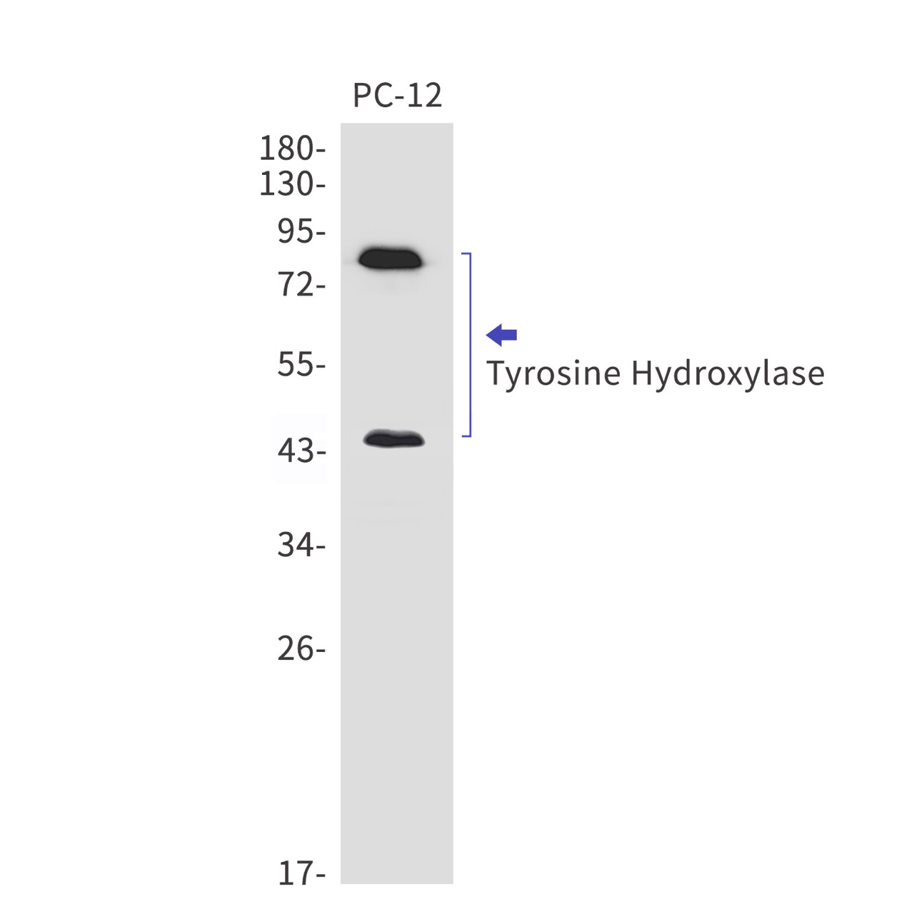 Tyrosine 3~monooxygenase