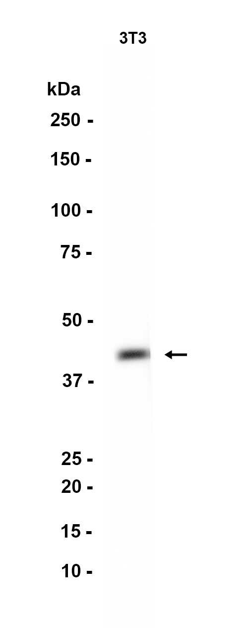 alpha smooth muscle Actin