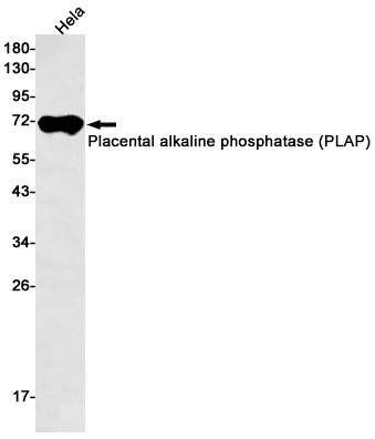 Placental Alkaline Phosphatase