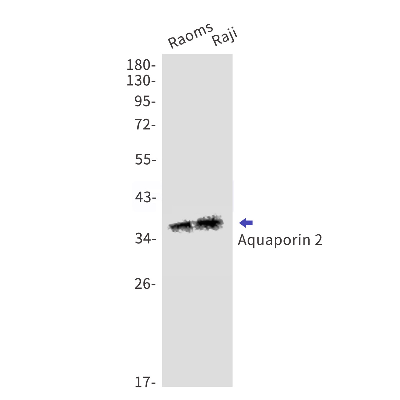 Aquaporin 2
