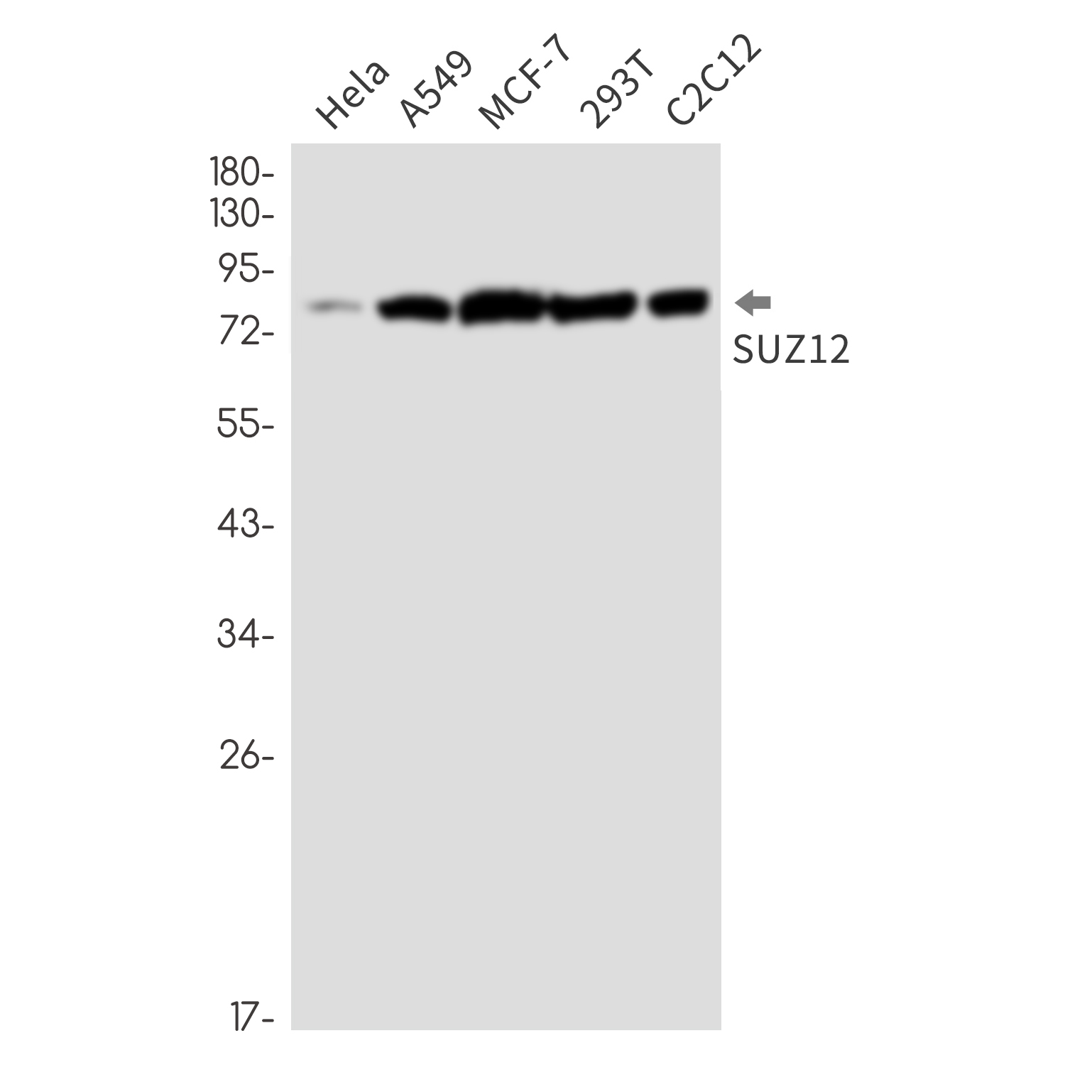 Polycomb Protein SUZ12
