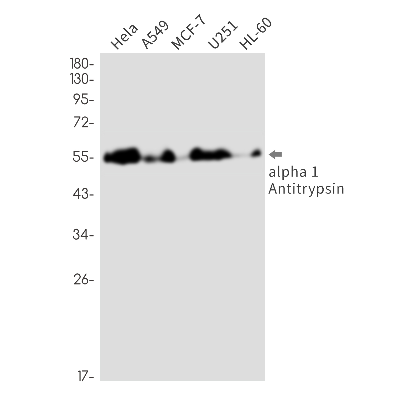 alpha 1 Antitrypsin