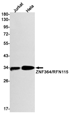 ZNF364