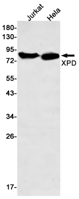 XPD