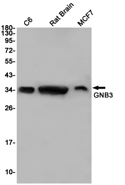 GNB3