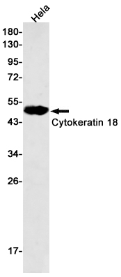 Cytokeratin 18