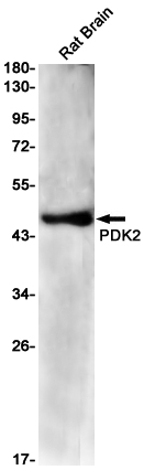 PDK2