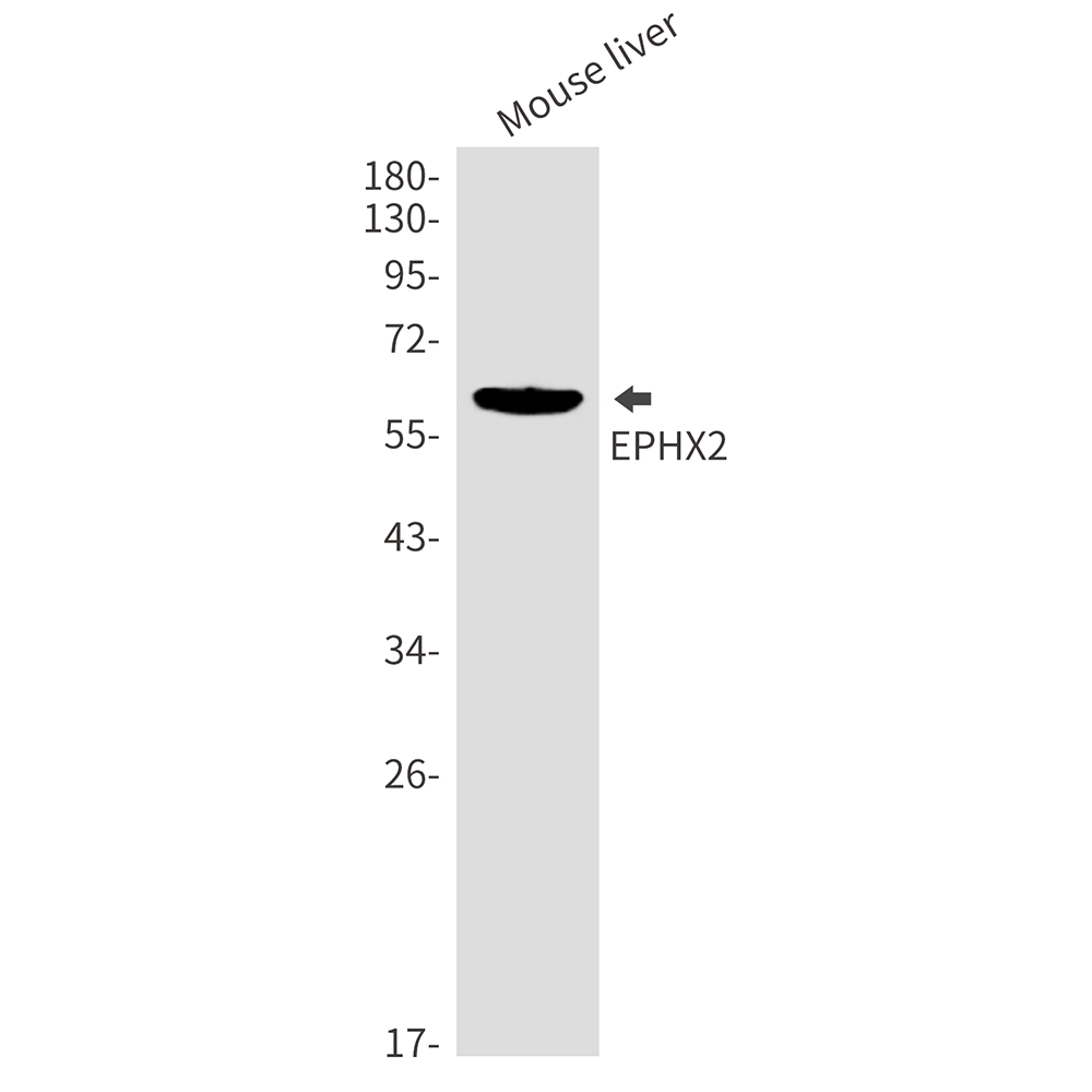 Epoxide Hydrolase 1