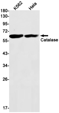 Catalase